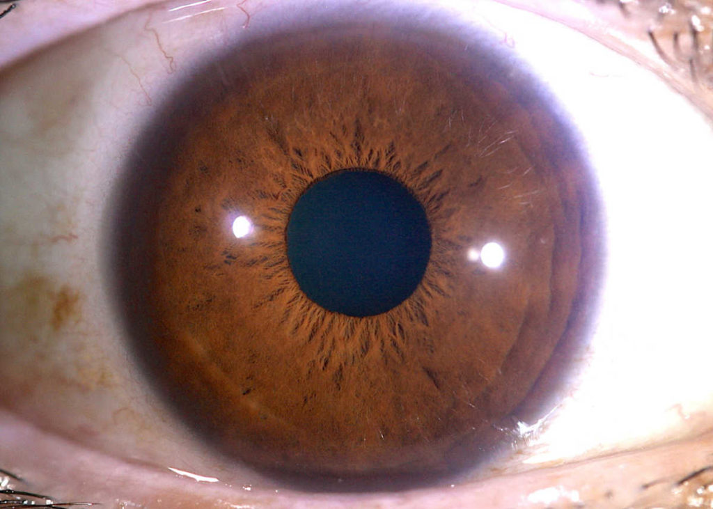 Un iris brun avec en son centre la pupille